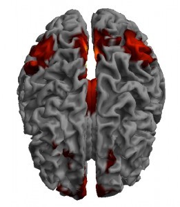 Posner-MRI-261x300