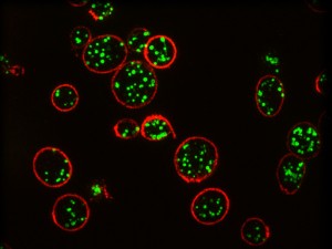 SIM image of platelets. Professor Dan Cutler, UCL